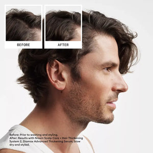 Nioxin System 2 Trial Kit 150 ml